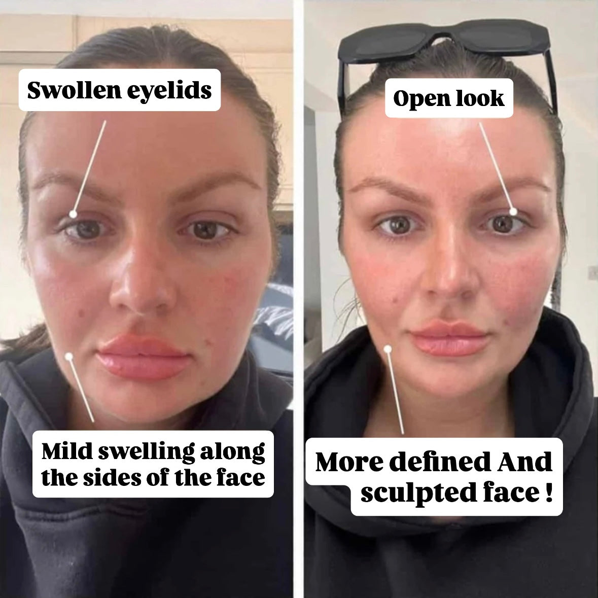 VAPOURA™ Organic Lymphatic Support Herbal Blend